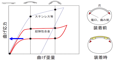 図4　超弾性合金の機械的特性