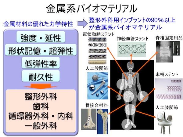 体の中で活躍する金属系バイオマテリアル | 東北大学 工学部 材料科学