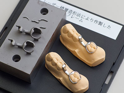 (図/写真1)歯科用の金属フレーム